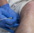 Anesthesia closeup through the leg
