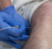 Anesthesia closeup through the leg