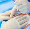 C-Section procedure in the OR