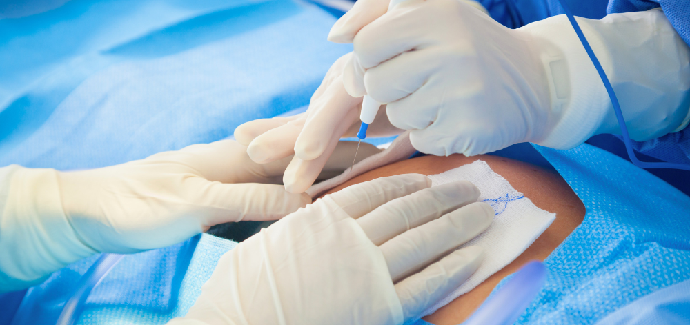 C-Section procedure in the OR