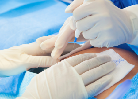 C-Section procedure in the OR