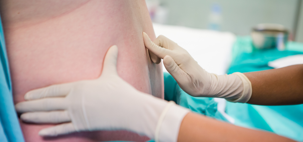 CRNA before administering epidural