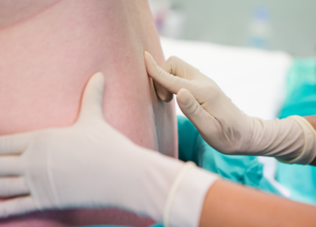 CRNA before administering epidural